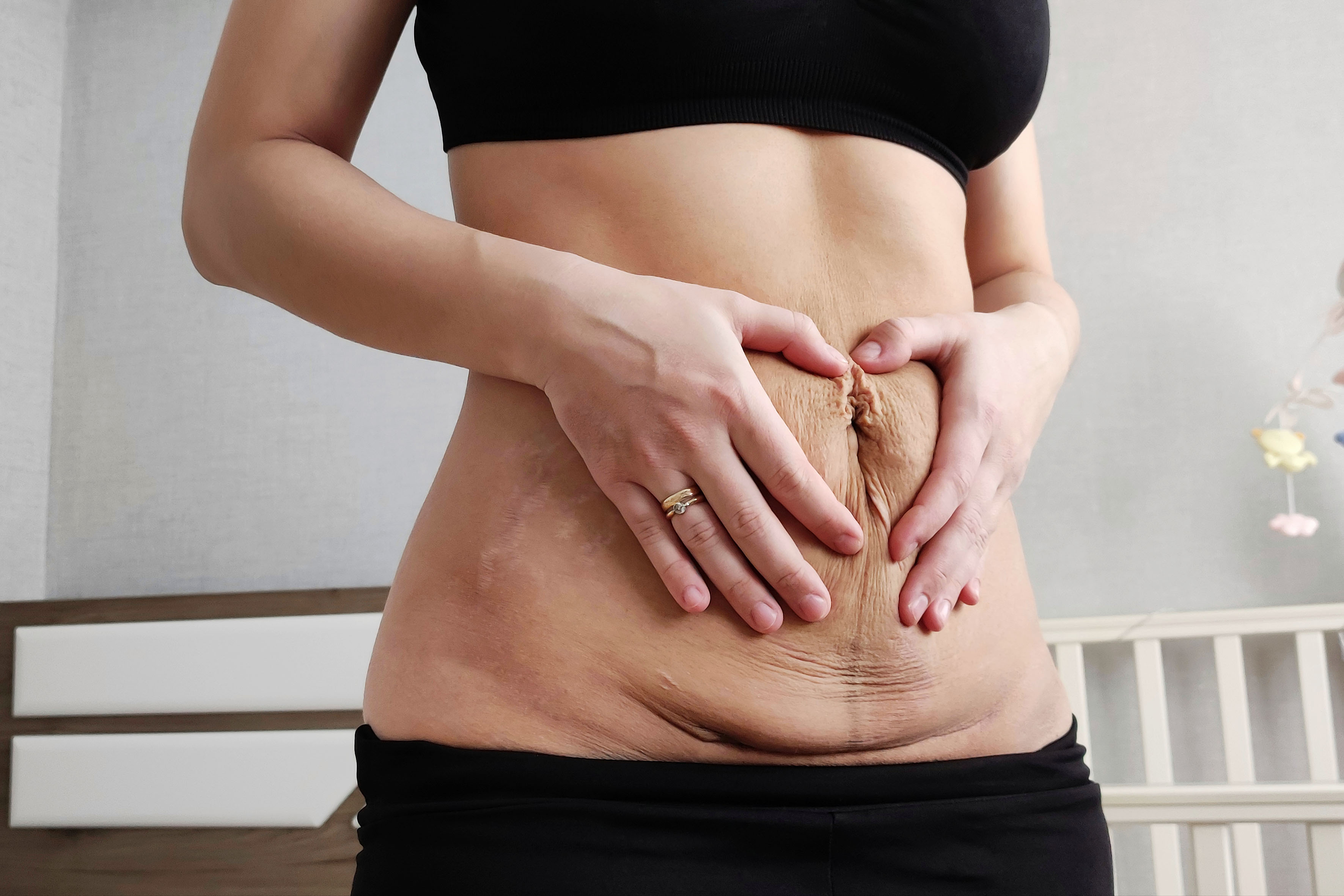 Postpartum Recovery Postpartum Recovery